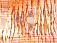 Radial section